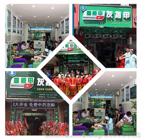 镇江/灰指甲加盟连锁全国招商中