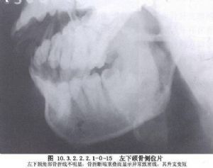 固定架英文 上升/调整固定支架用英文怎么写