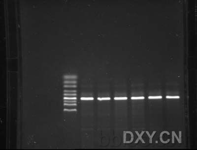 寡核苷酸的作用 寡核苷酸引物的作用是什么？在PCR实验中的作用