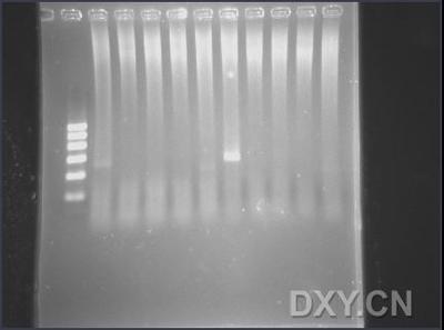 寡核苷酸引物 寡核苷酸引物的作用是什么？在PCR实验中的作用